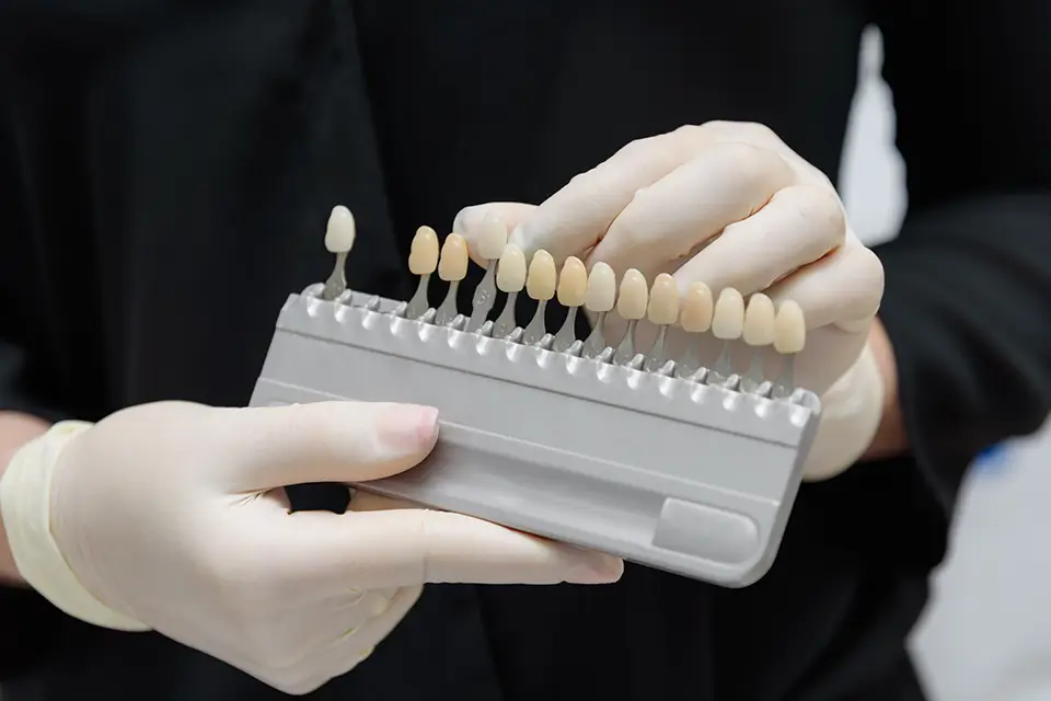 Types of Dental Veneers: A Practical Guide to Your Best Options