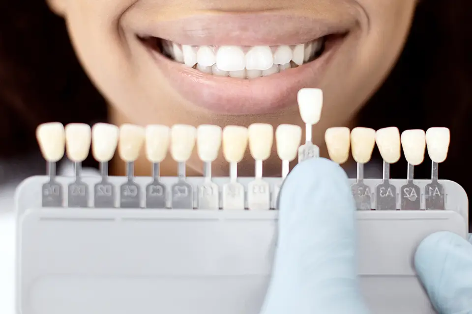Care, Longevity & Risks with Types of Dental Veneers