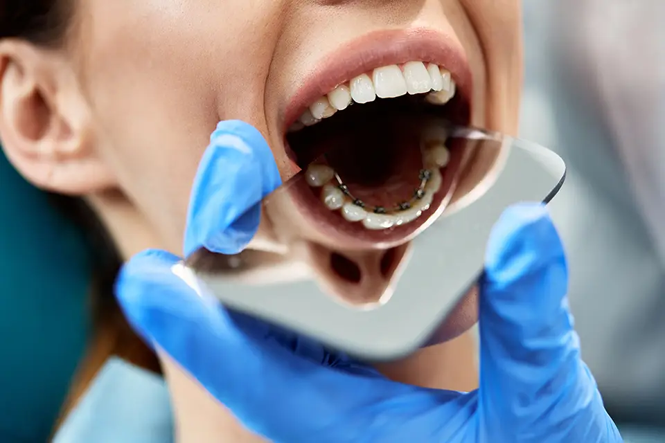 Orthodontics For Adults: How Teeth Actually Move