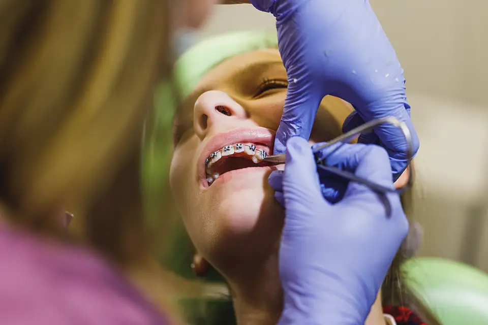 Orthodontics For Adults: A Practical Guide to Confident, Comfortable Treatment
