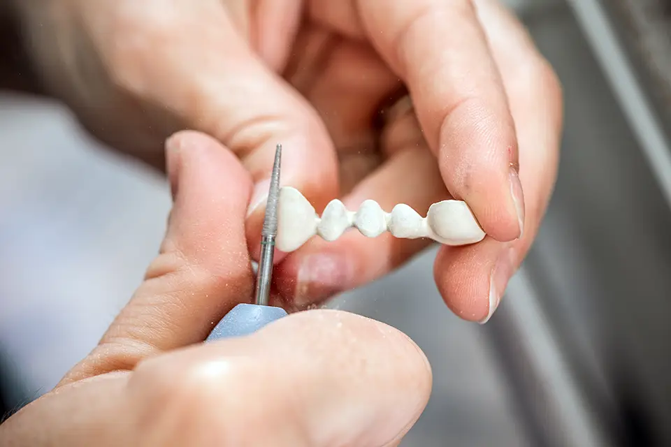 Dental Veneers vs Crowns: How to Choose the Right Fix for Your Smile