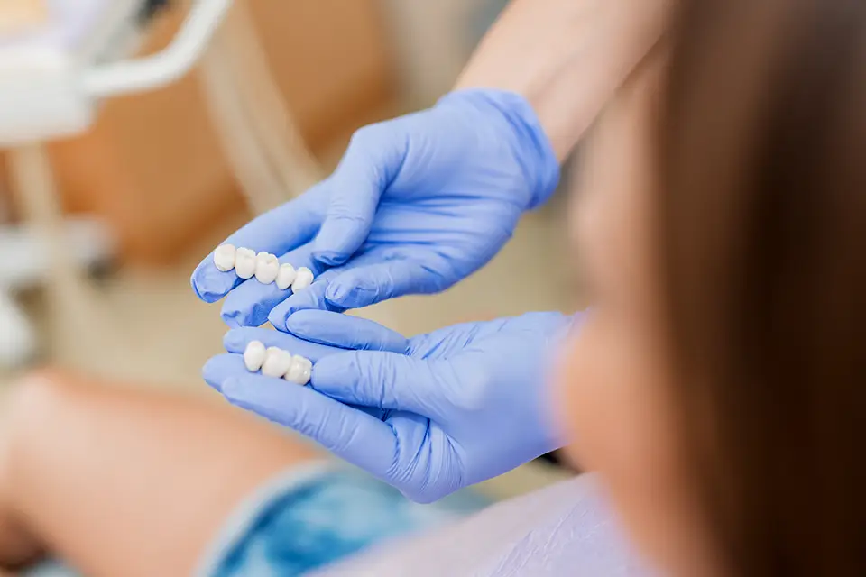 Risks and Benefits of Dental Veneers: What They Can—and Cannot—Do