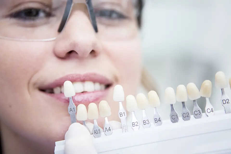 Dental Bonding vs Veneers: How To Choose Your Best Smile Upgrade