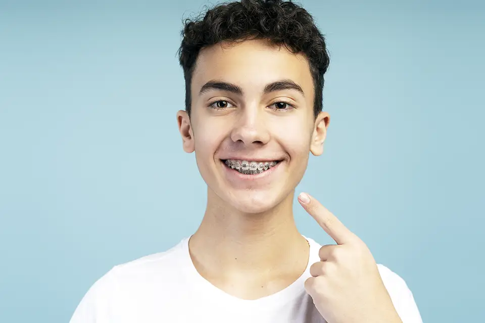 Average Time for Orthodontic Treatment: A Clear Timeline for Real-Life Results 2 Special Cases That Change the Average Time for Orthodontic Treatment