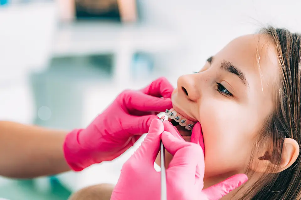 Common Risks and Complications Of Orthodontics Patients Should Know