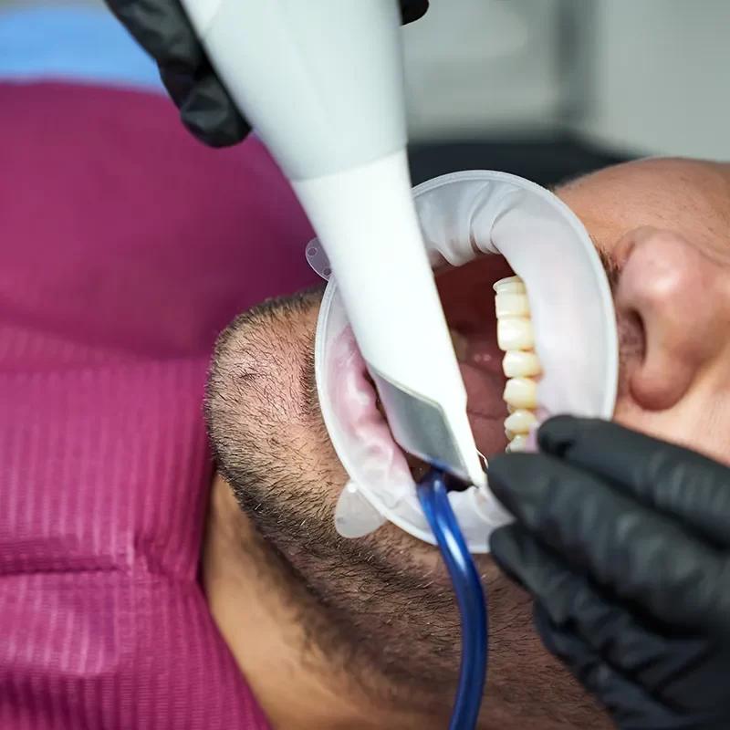 What Is a Dental Exam?