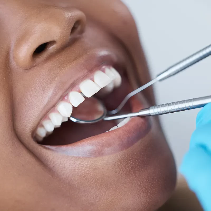 Our Dental Exam Process at Ajax Aria Dentistry​