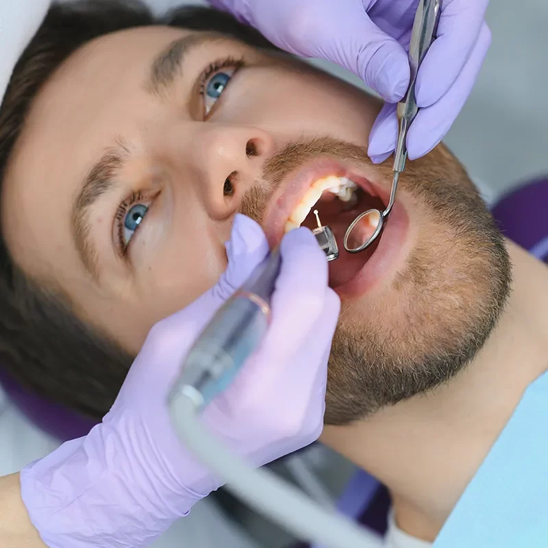 What to Expect: The Dental Filling Process