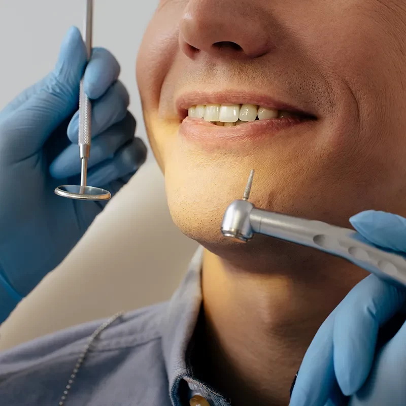 What Are Fluoride Treatments?