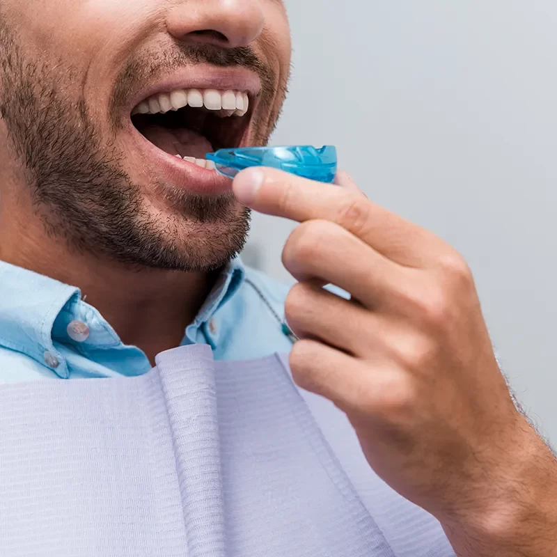 What Is a Night Guard for Bruxism?