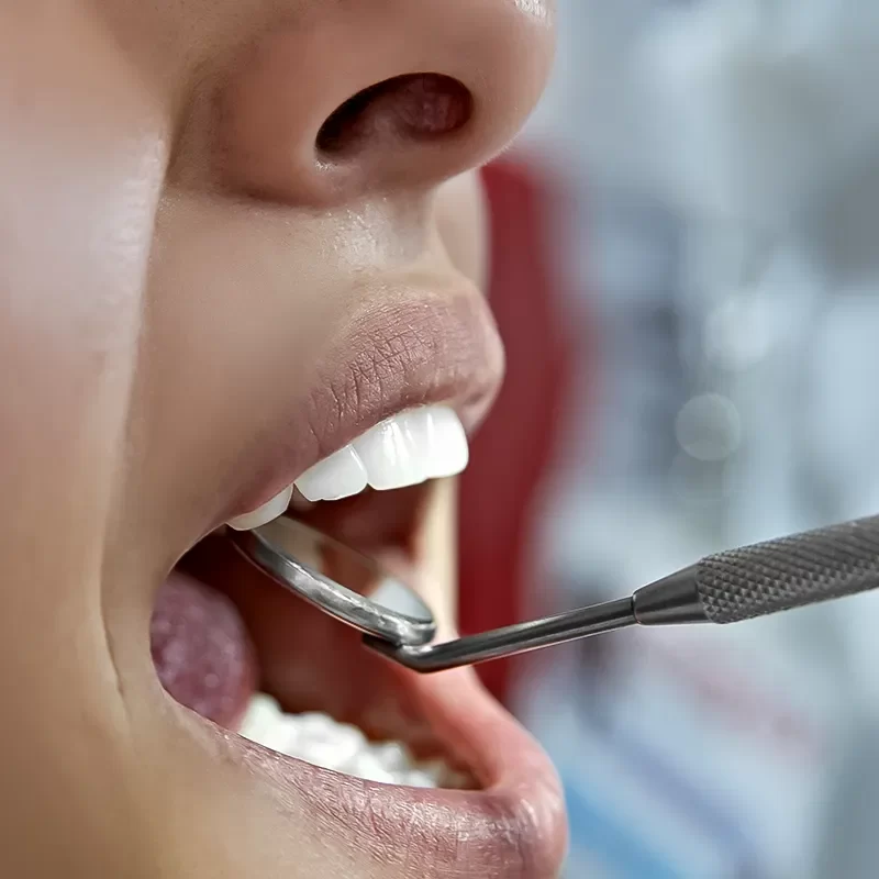 Our TMJ Treatment Process: Steps to Lasting Relief