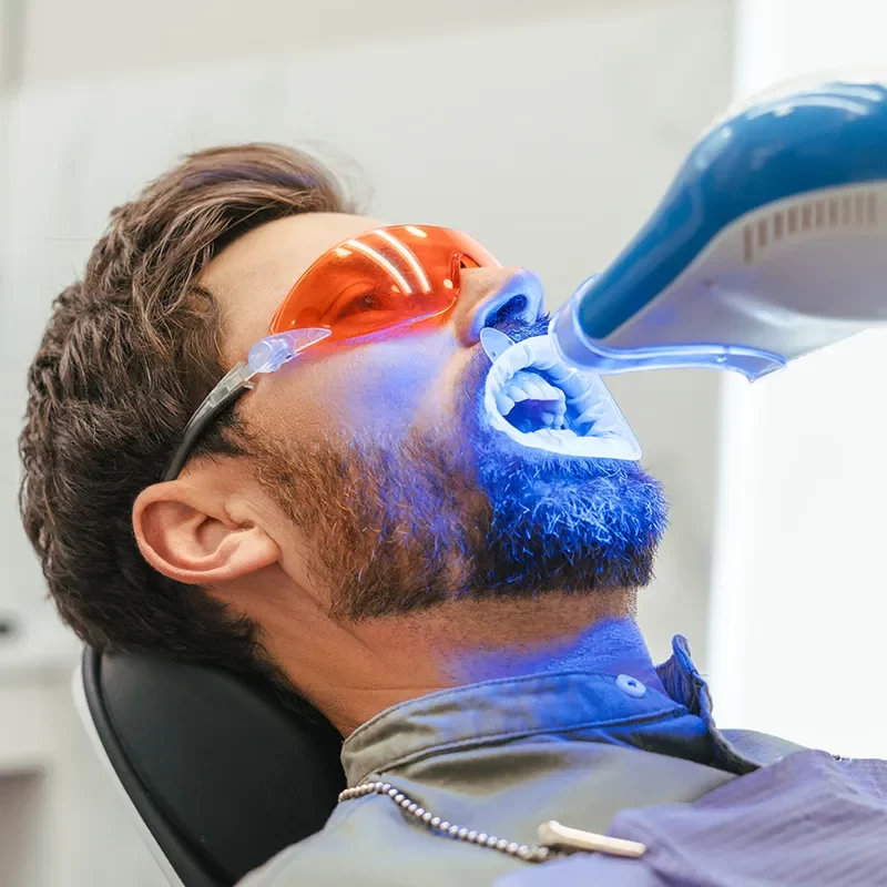 What Is Teeth Whitening?