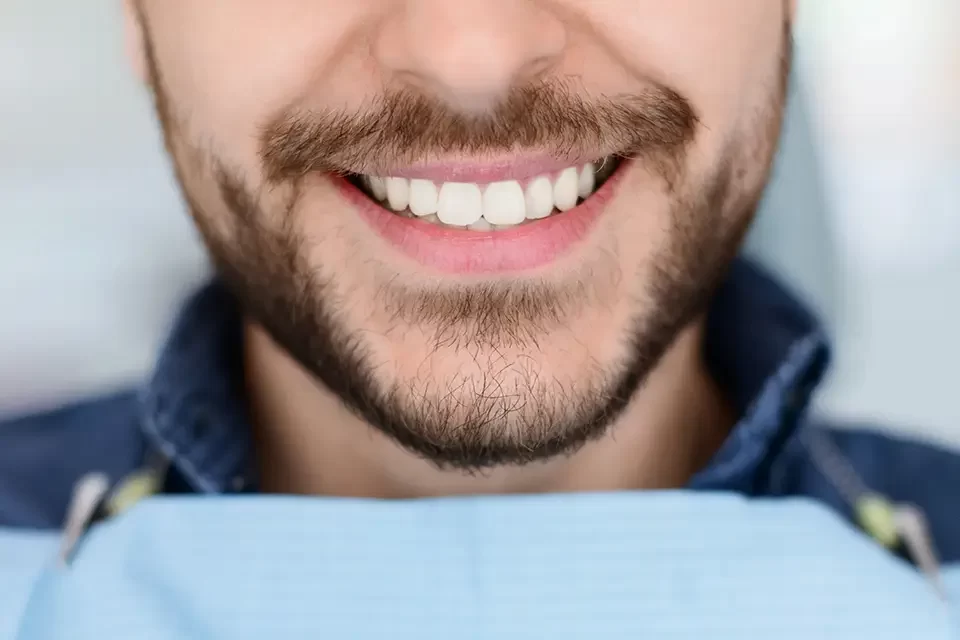 Cost & Value: Using the Difference Between Veneers and Composite Bonding to Plan a Smart Budget