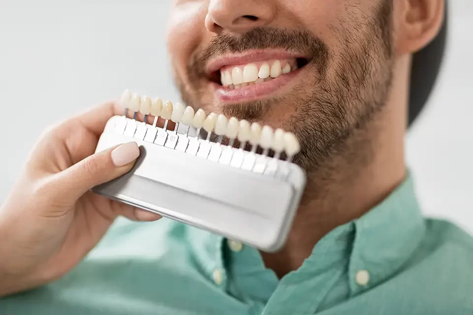 Types of Dental Veneers: Composite Veneers